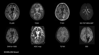 Brain X-ray image