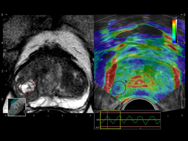 Real-time Visual Sonography (RVS) - SeeLearn Europe